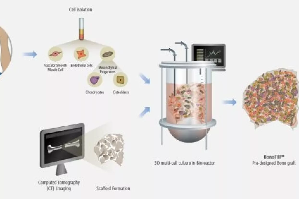 Izraelska biotech kompanija uspje&scaron;na u uzgoju i regeneraciji kostiju