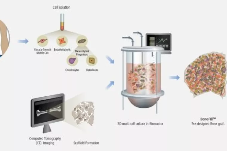 Izraelska biotech kompanija uspje&scaron;na u uzgoju i regeneraciji kostiju