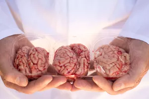 'Franken&scaron;tajnski pothvat': Znanstveni tim Nenada &Scaron;estana aktivirao svinjski mozak izvan tijela