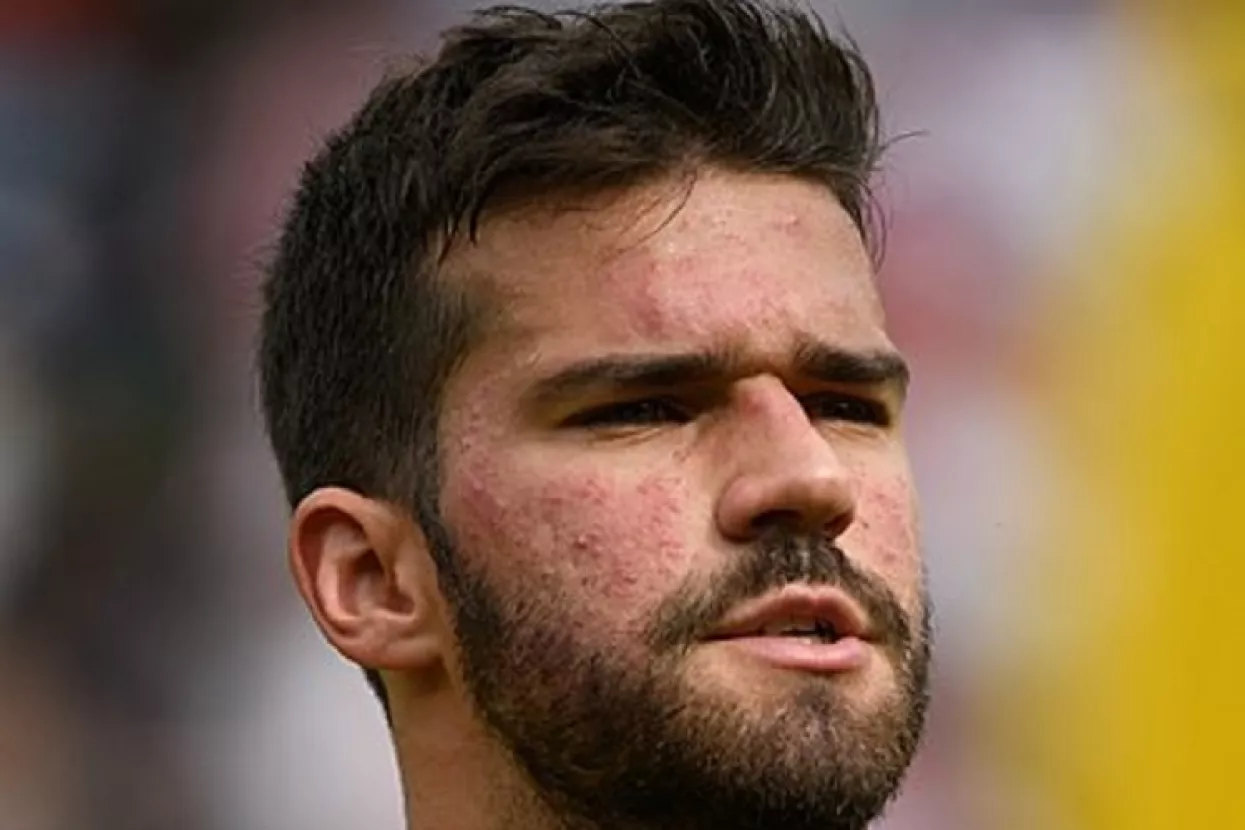 Alisson Becker najskuplji vratar svih vremena - pre&scaron;ao iz Rome u Liverpool za 72 milijuna eura