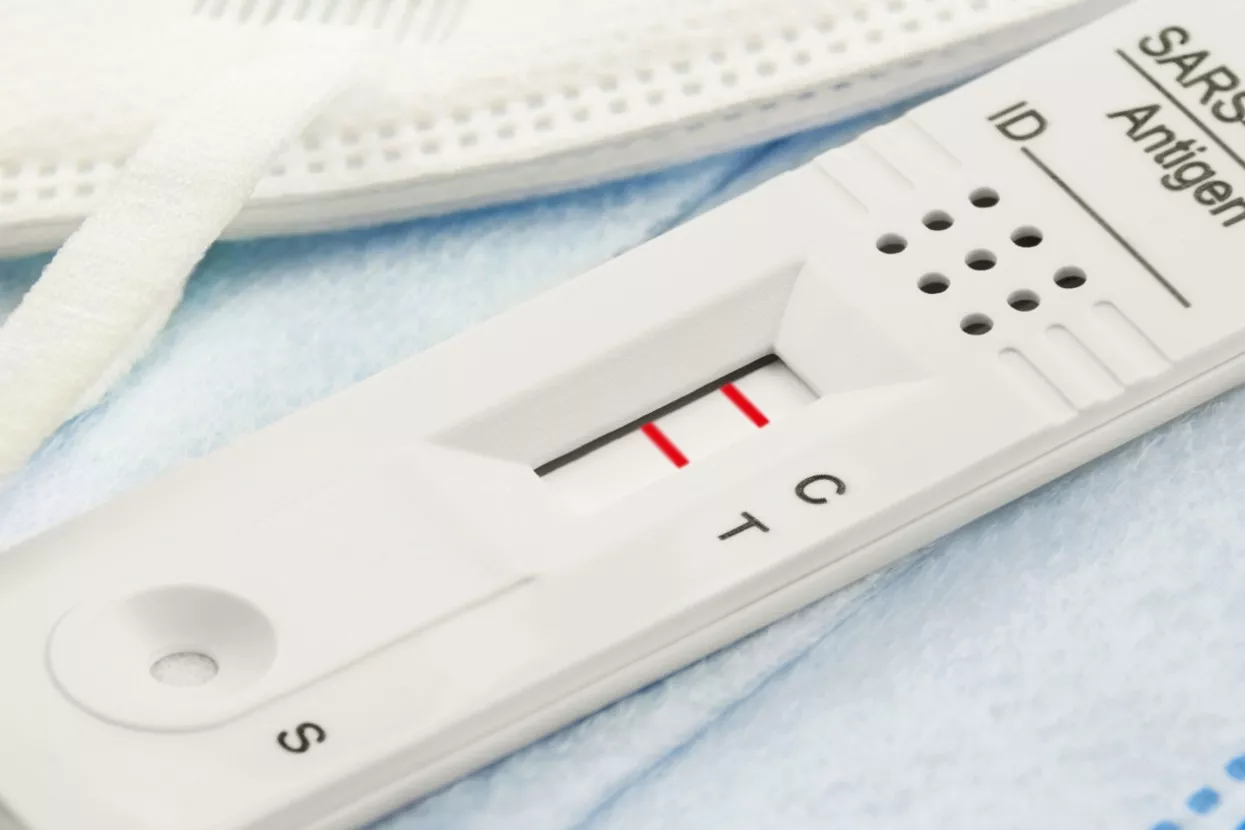 Novi hit na trži&scaron;tu brzi su antigenski testovi