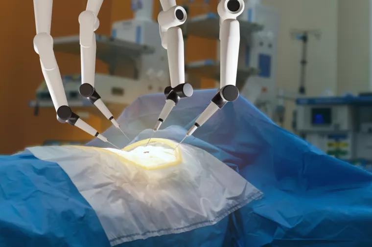 robotska ruka, operacija