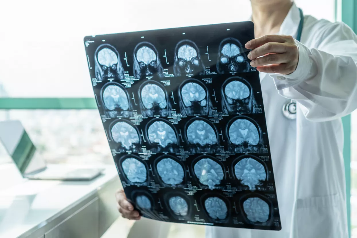 neurologija studij