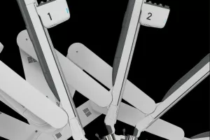 Radiochirurgia Zagreb - Robotska Kirurgija Da vinci_2